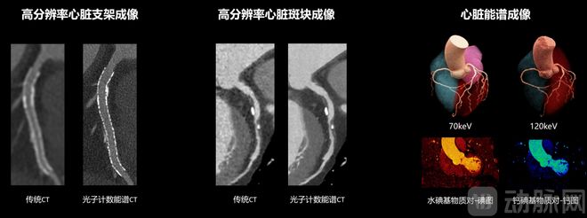 中国高端影像设备制造终于走到了世界最前沿